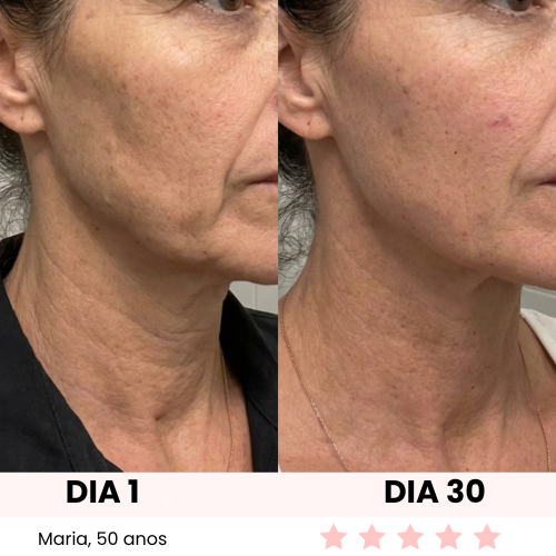 LUX GLOW ESCULTOR FACIAL