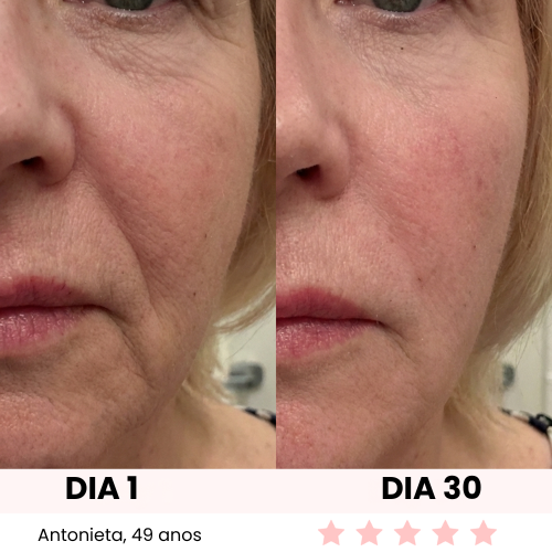 LUX GLOW FACIAL SCULPT