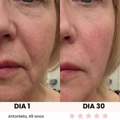 LUX GLOW ESCULTOR FACIAL