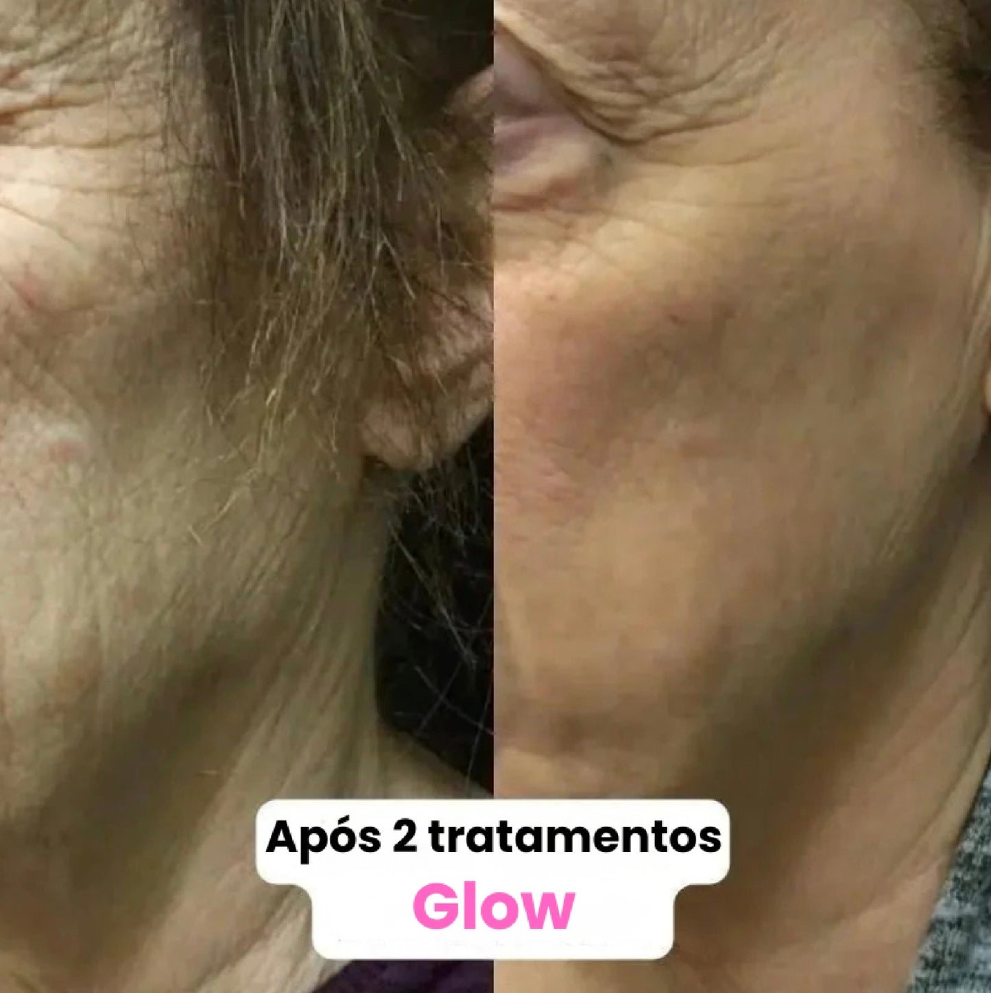 GLOW BEAUTY INFUSION