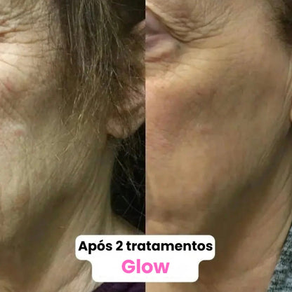 GLOW BEAUTY INFUSION