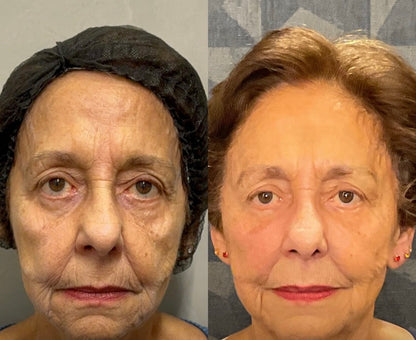 GLOW BEAUTY INFUSION