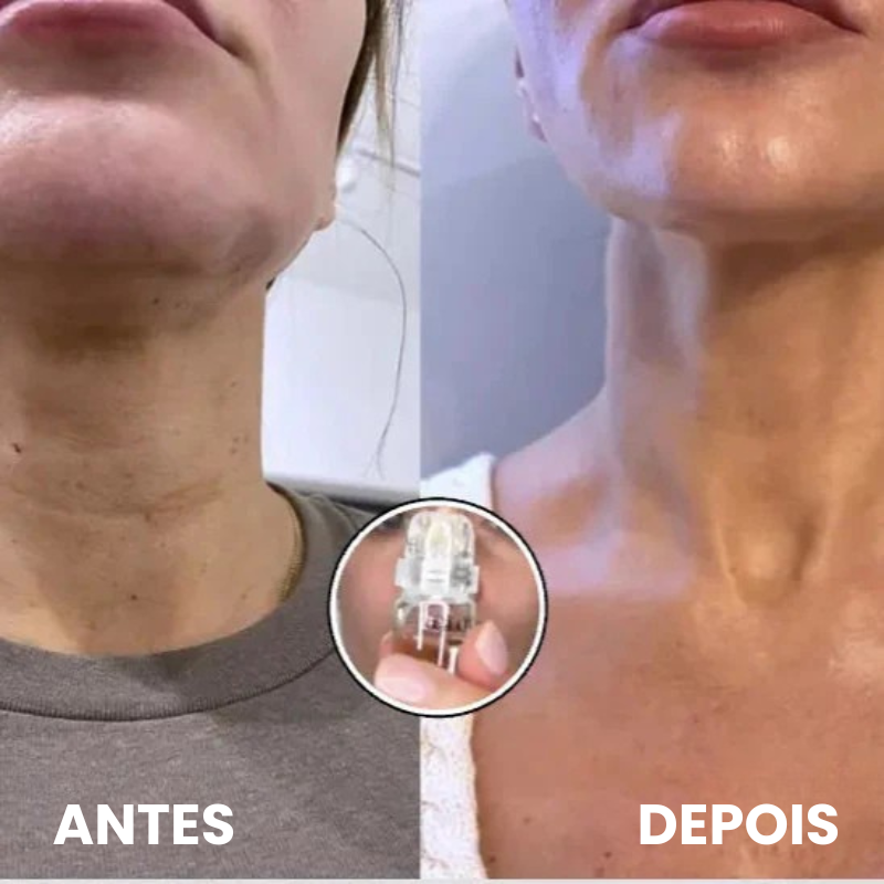 GLOW PELE INFUSION SYSTEM